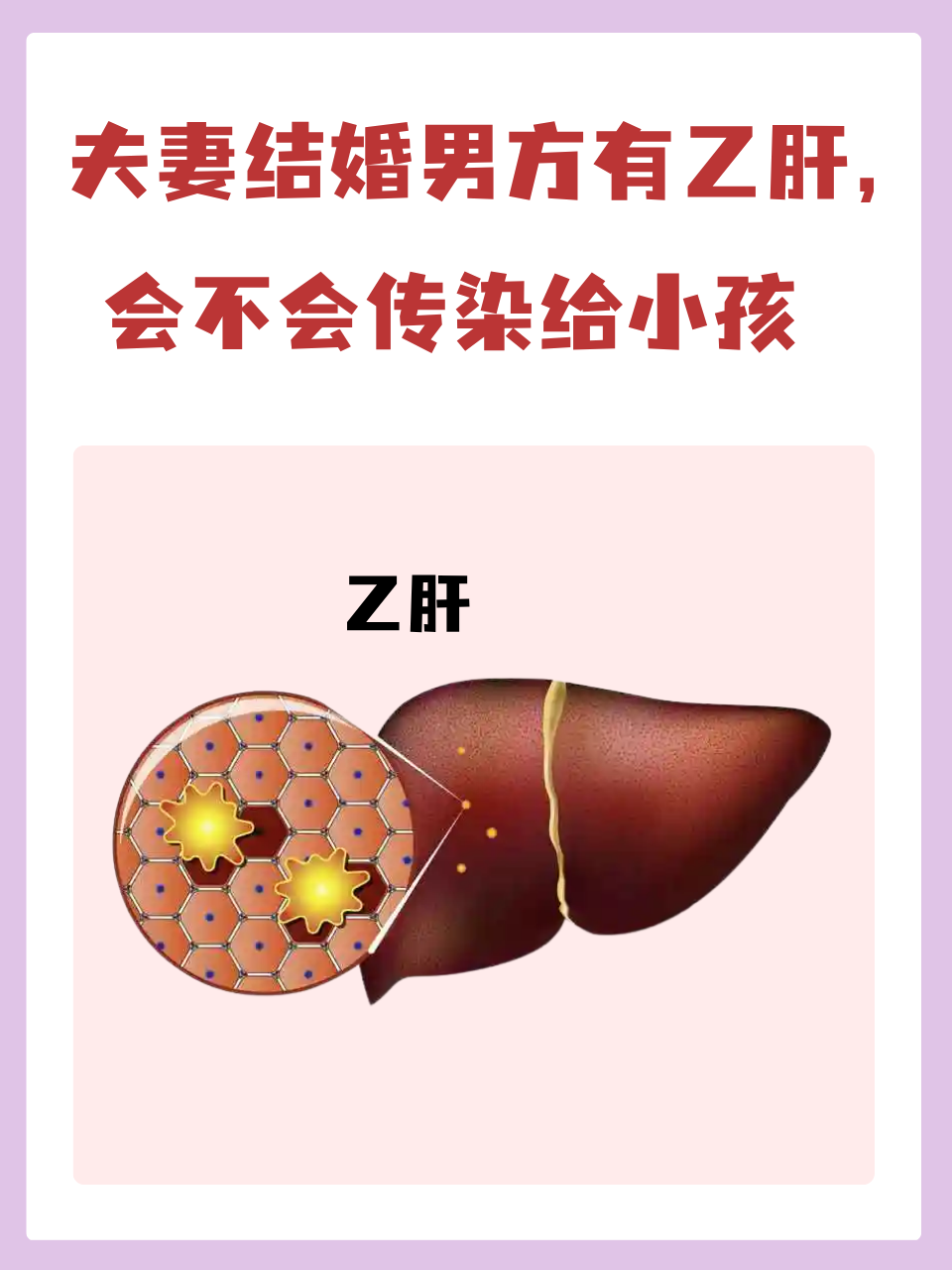 乙肝患者可以结婚吗