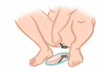 肛门上有毛是正常的吗
