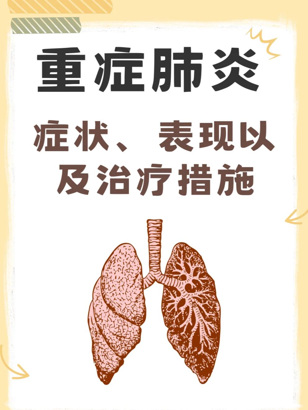 肺炎怎么治疗最好