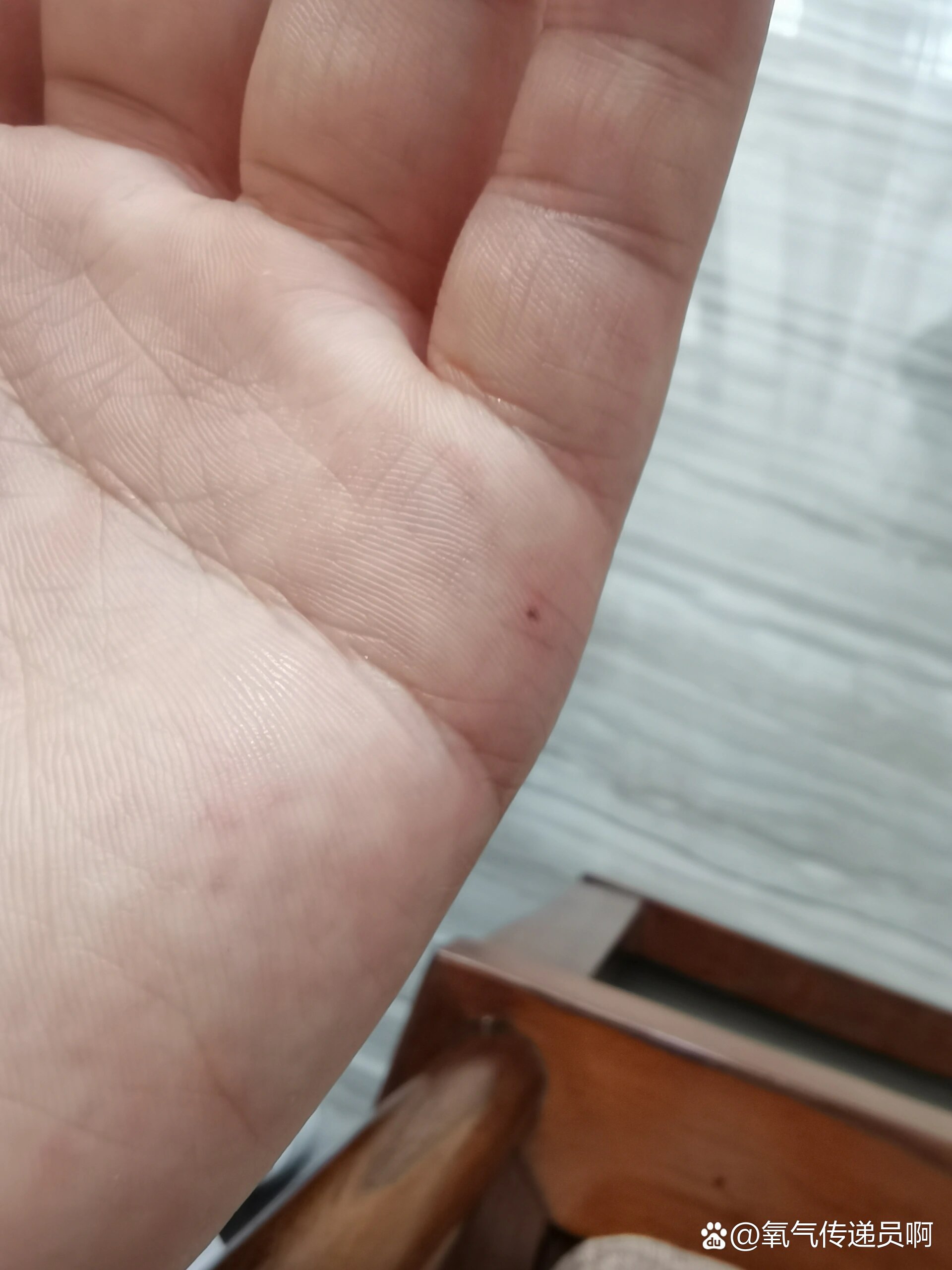 手上起小红点