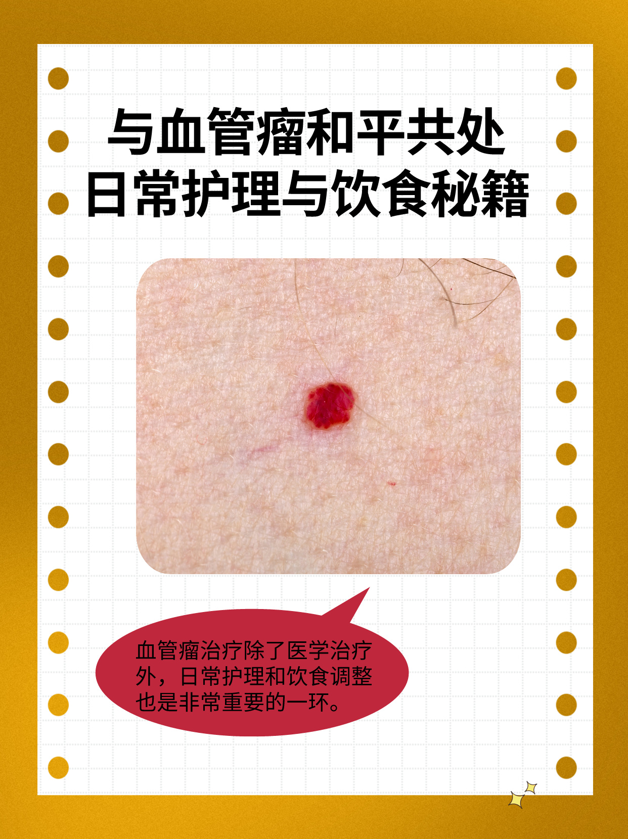 肝脏血管瘤会自愈吗