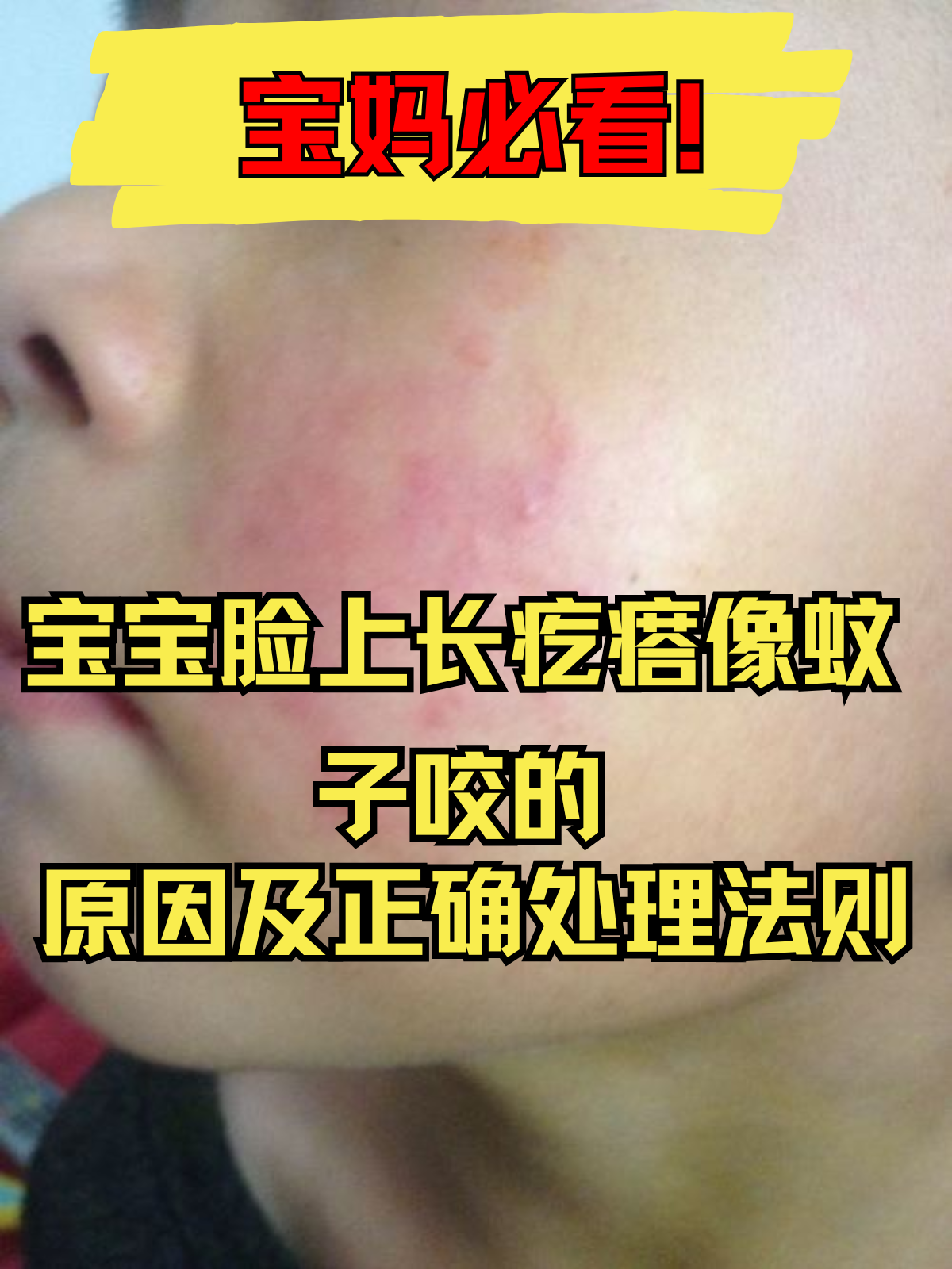 脸上起了好多小疙瘩怎么办