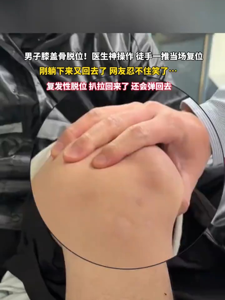 膝盖脱臼的治疗方法