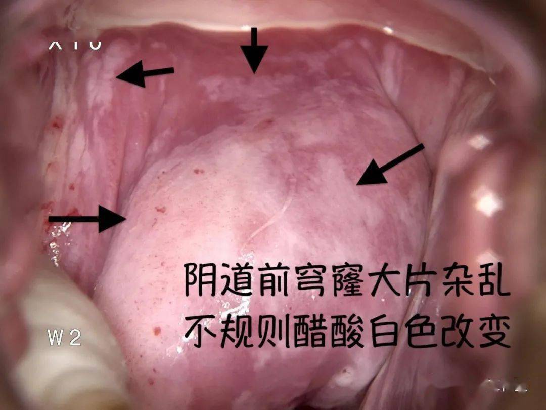 阴道微生态是什么