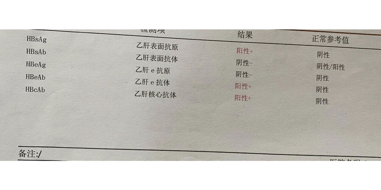 乙肝抗体阳性是什么意思?