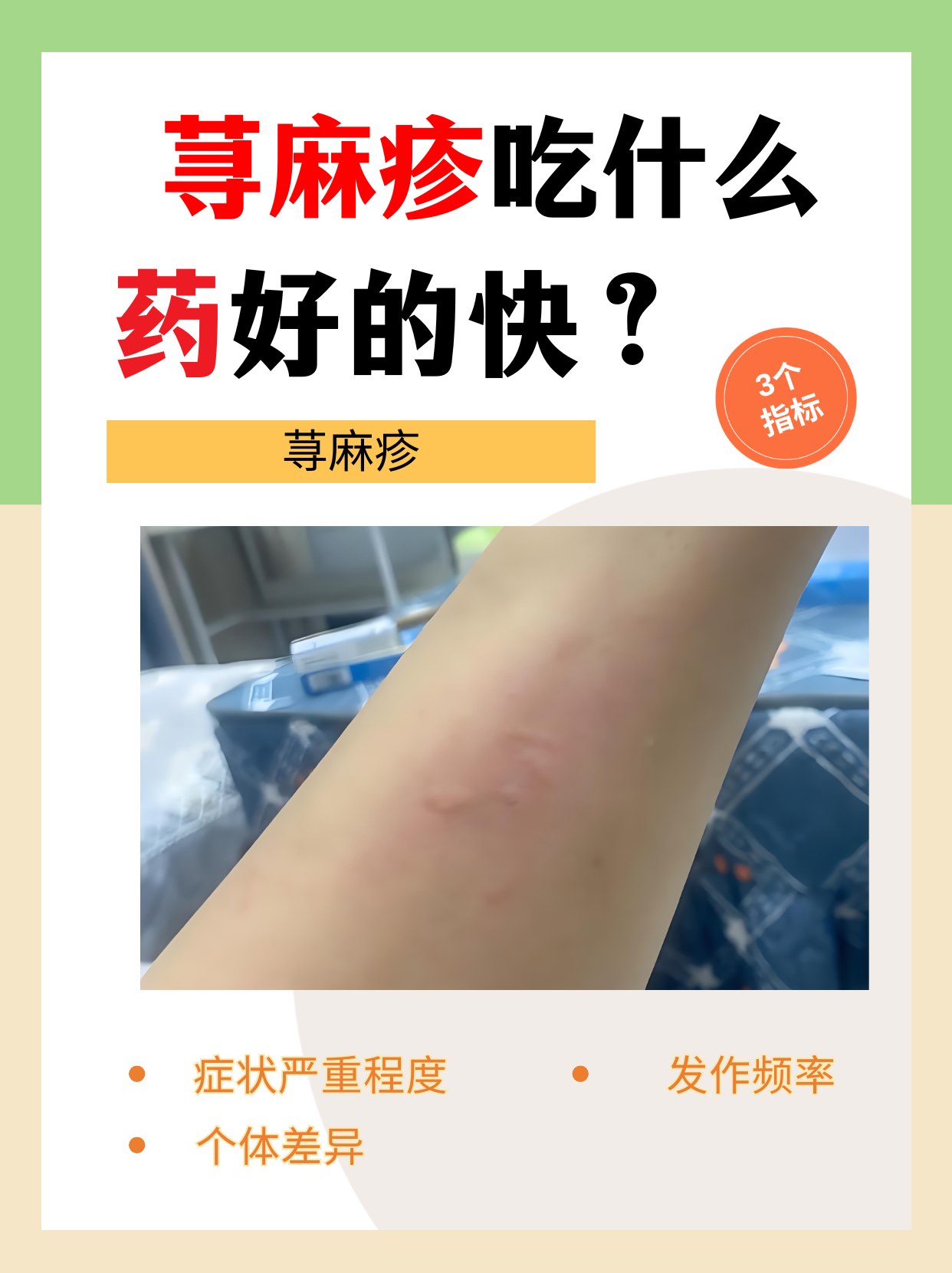 荨麻疹吃什么药好得快?