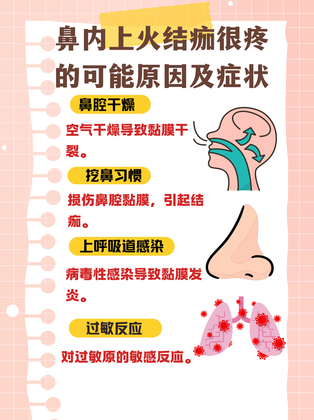 鼻子里干燥结痂怎么办