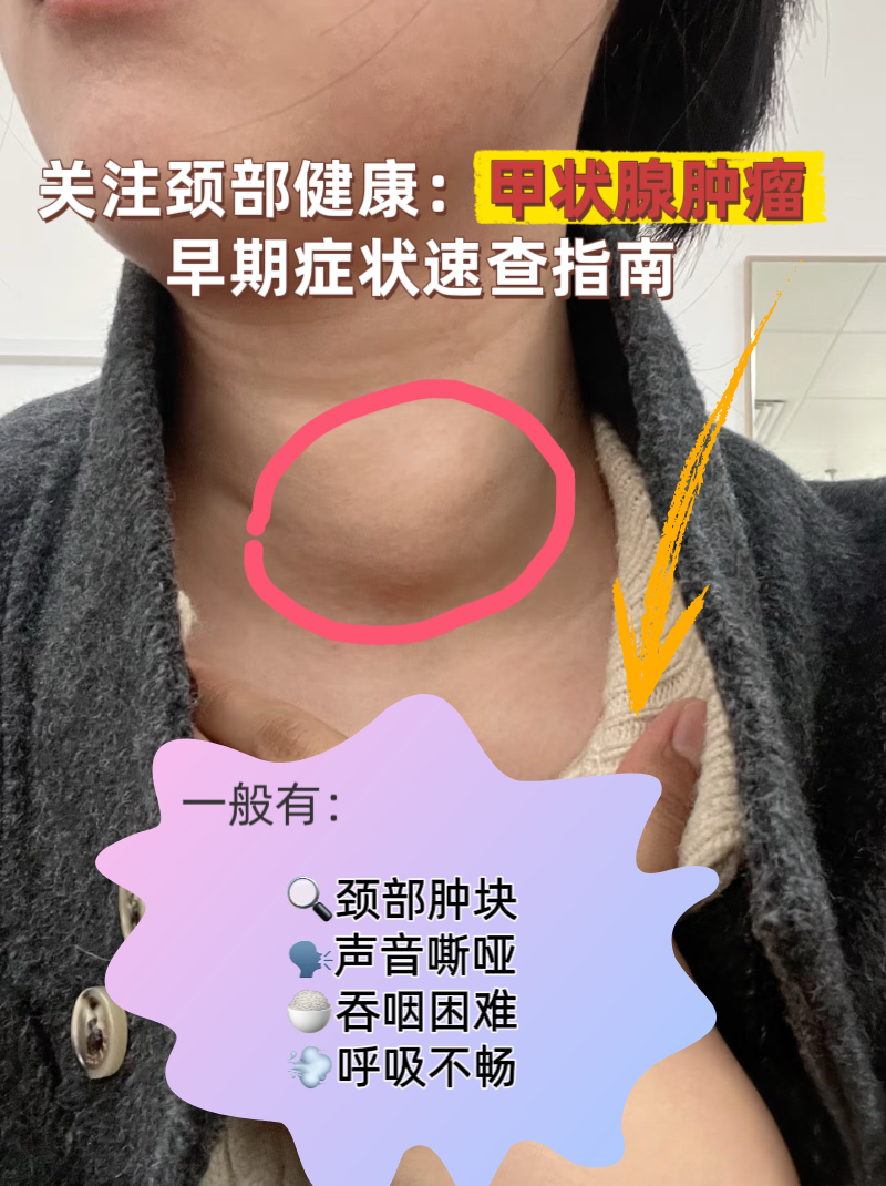 甲状腺弥漫性肿大是怎么回事