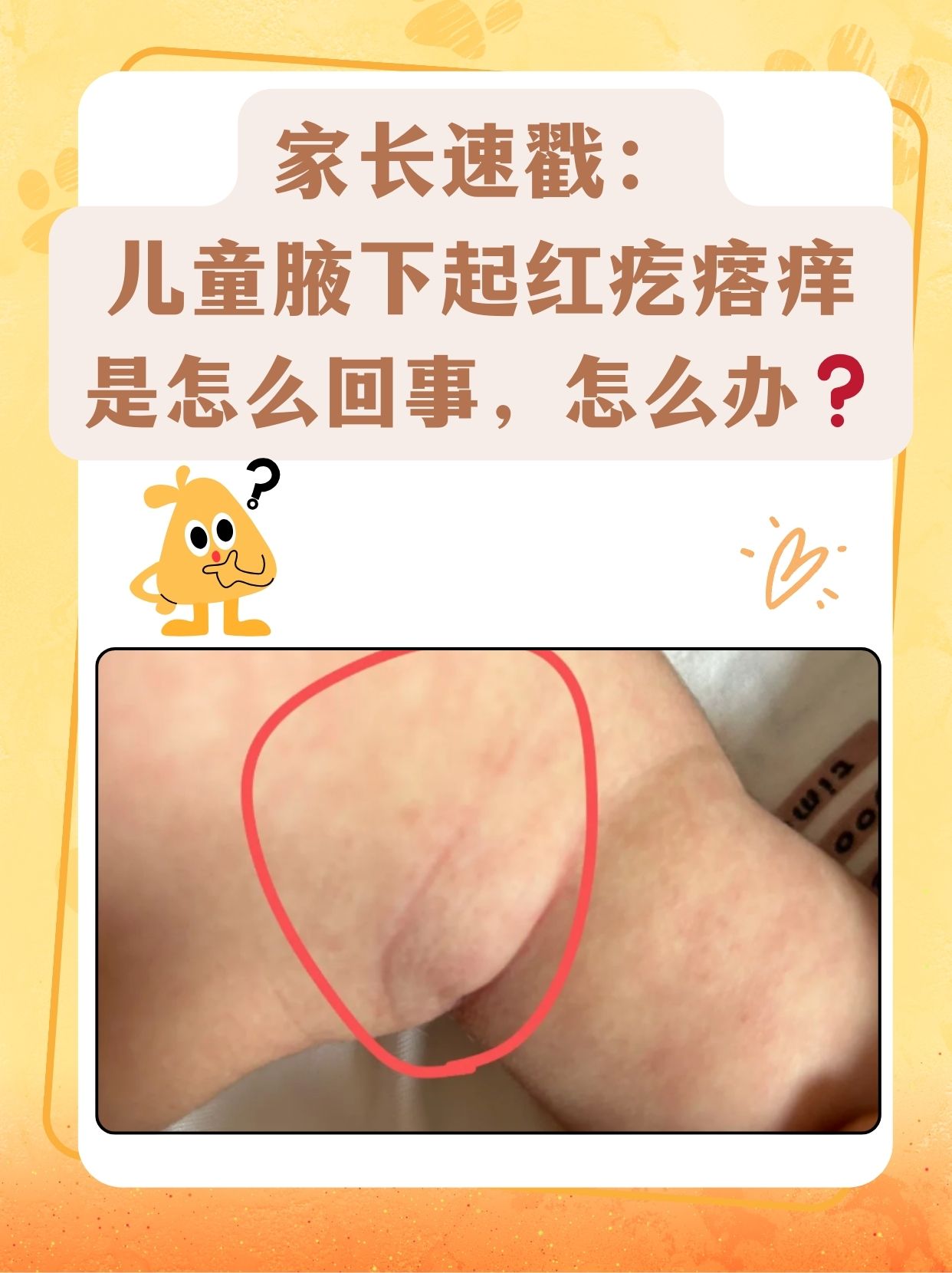 身上起红疙瘩很痒怎么办?