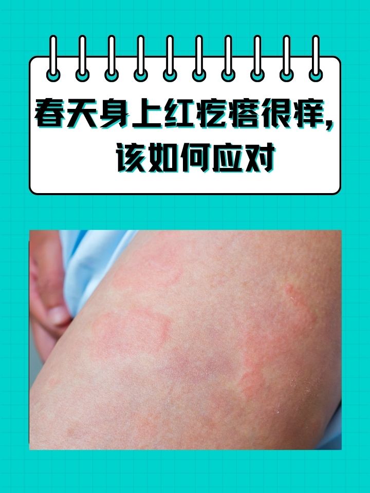 身上起红疙瘩很痒怎么办?