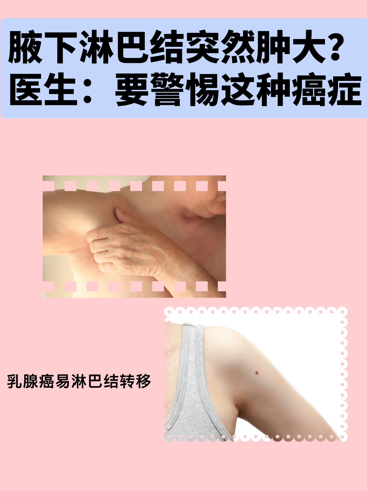 腋窝淋巴结肿大疼痛怎么办