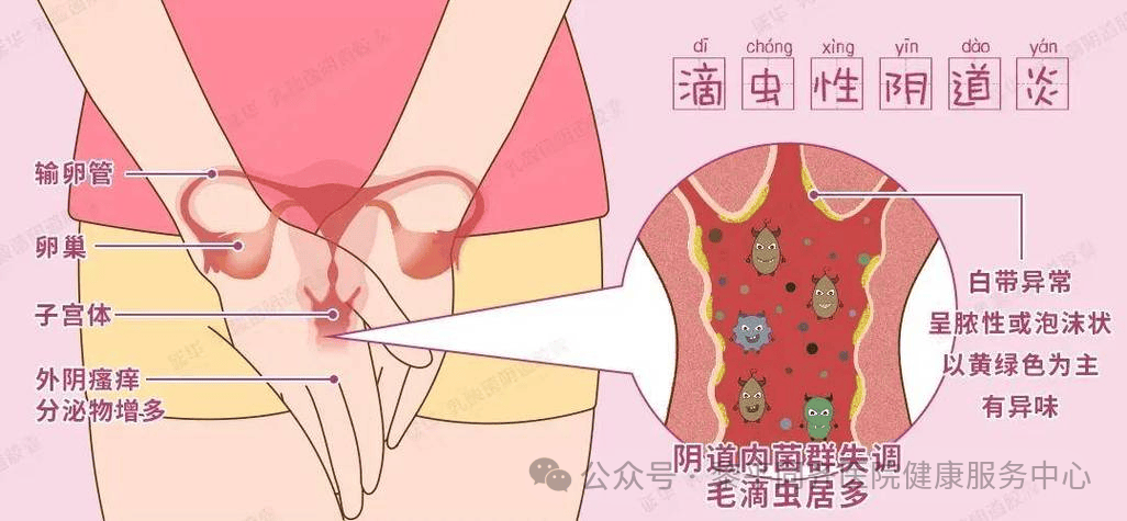 萎缩性阴道炎