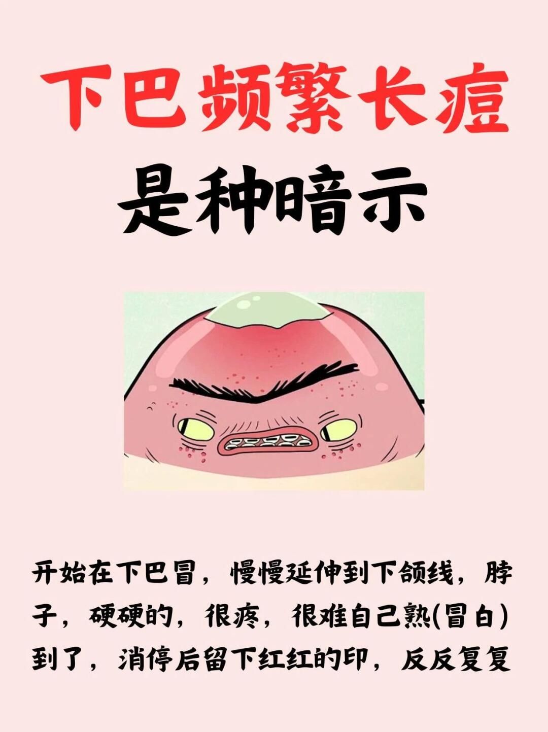 下巴一直长痘痘是什么原因