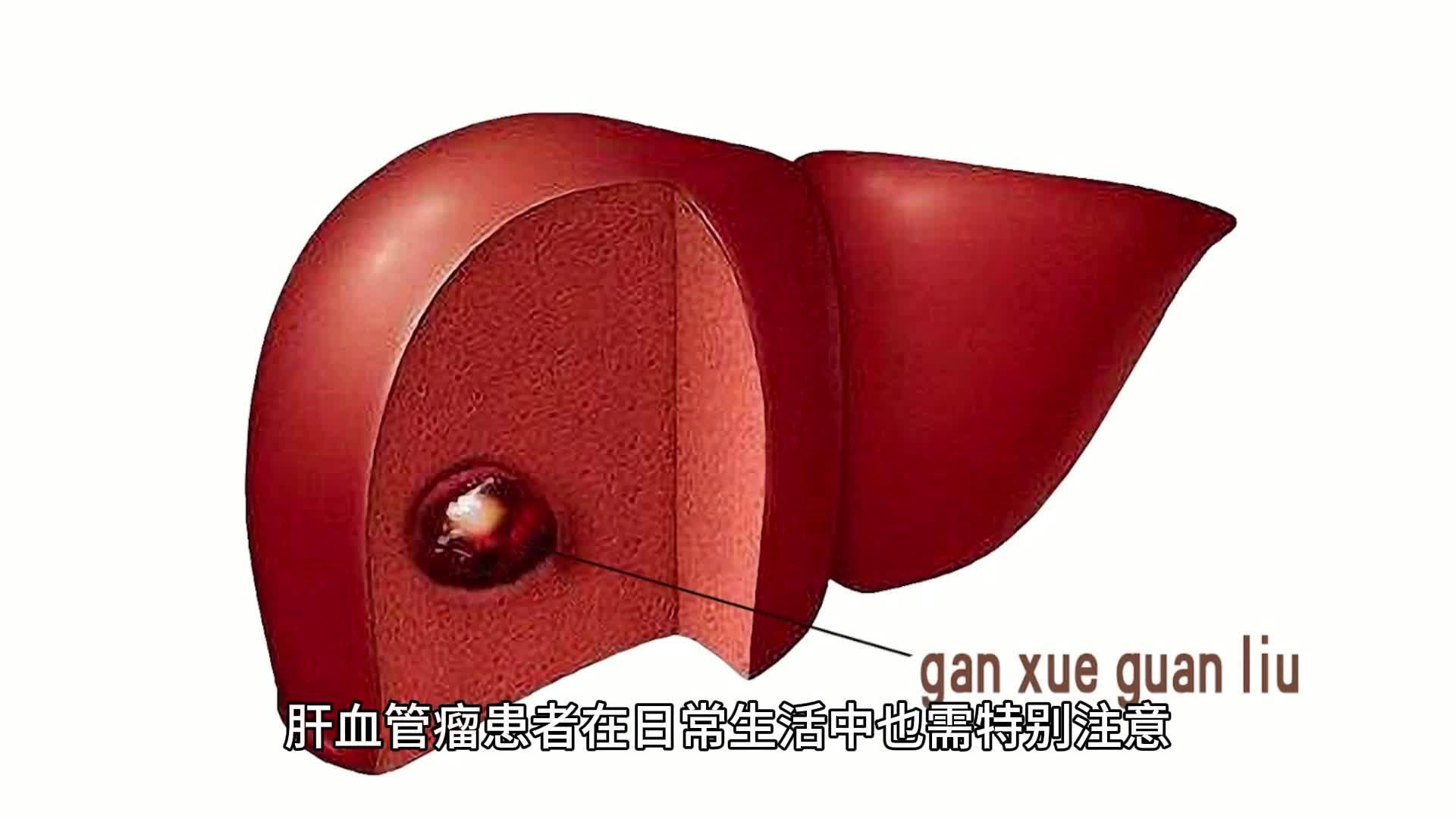 肝上长了血管瘤严重吗?