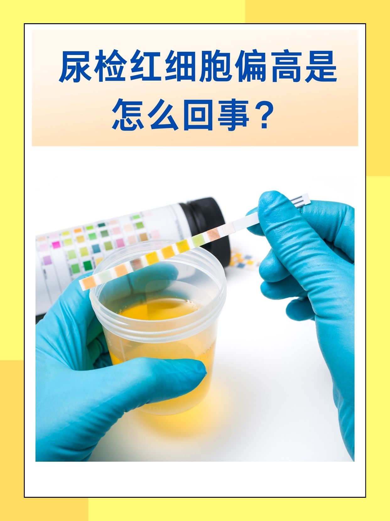 尿化验红细胞偏高