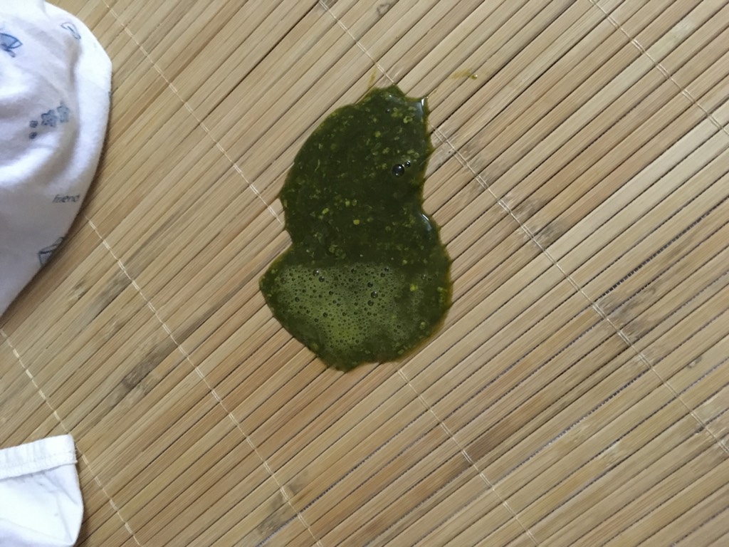 便便绿色的正常吗?