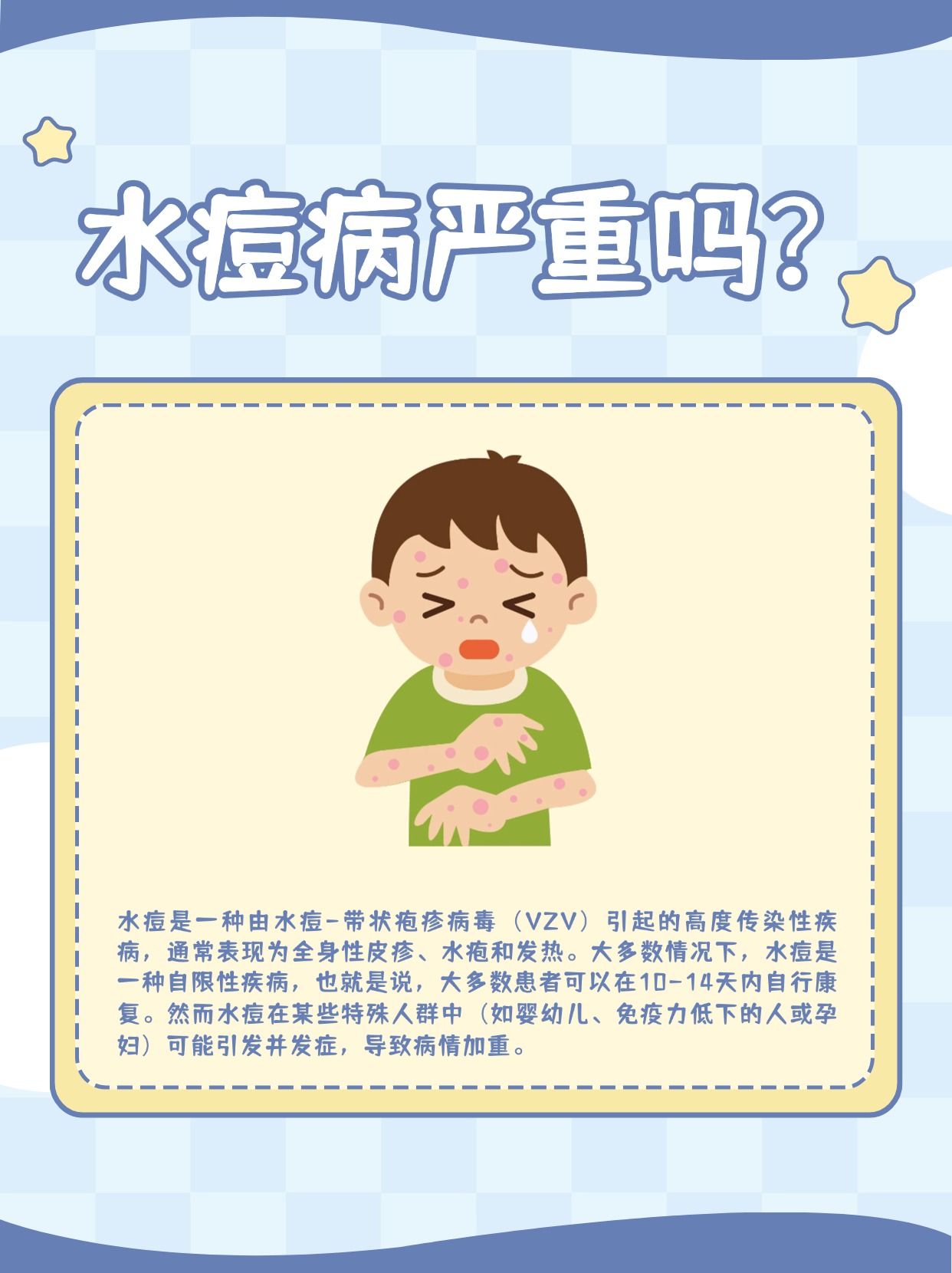 水痘的潜伏期