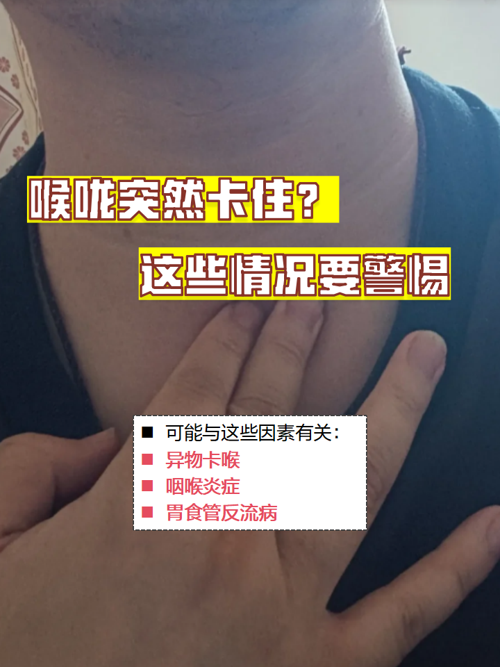 什么是深喉