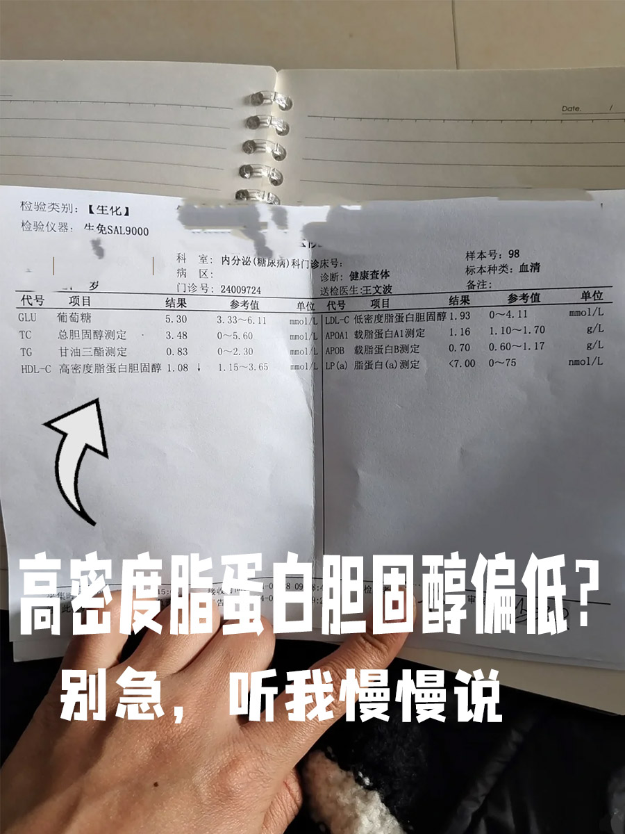 高密度脂蛋白胆固醇偏低是什么回事