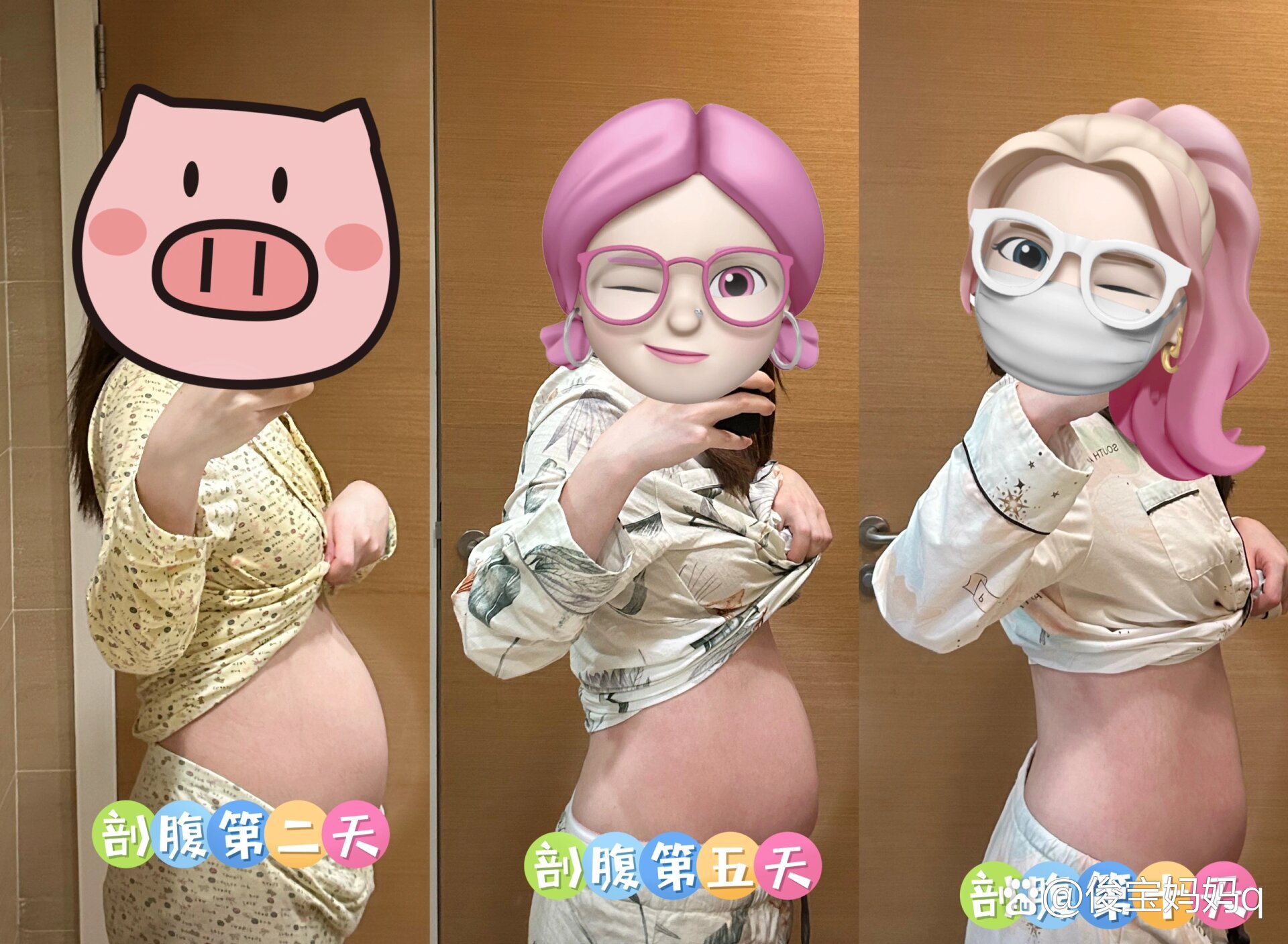 剖腹产后十天同房会不会怀孕