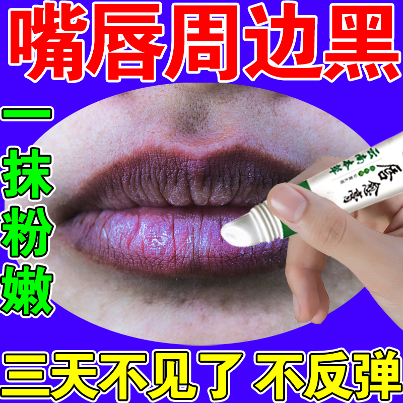 嘴唇周围发黑怎么去除
