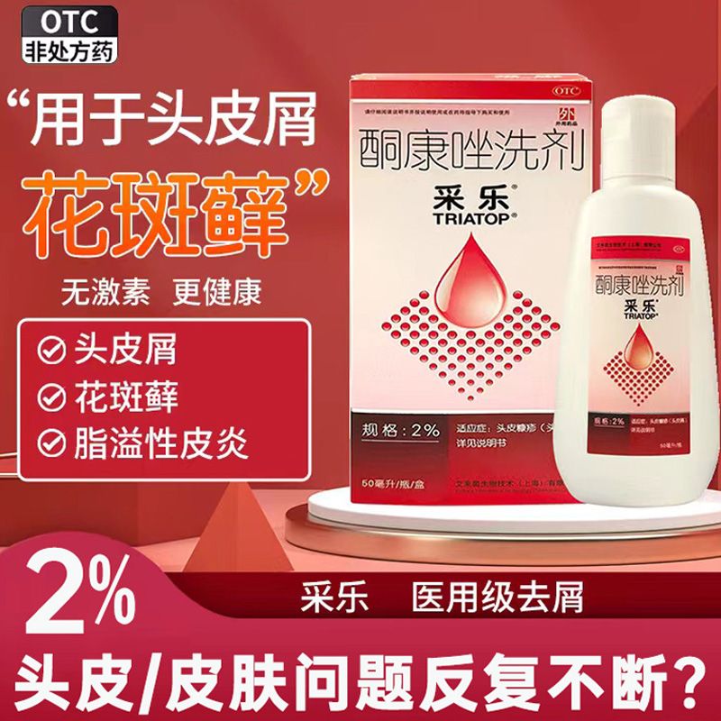 头屑多头皮痒,怎么治疗