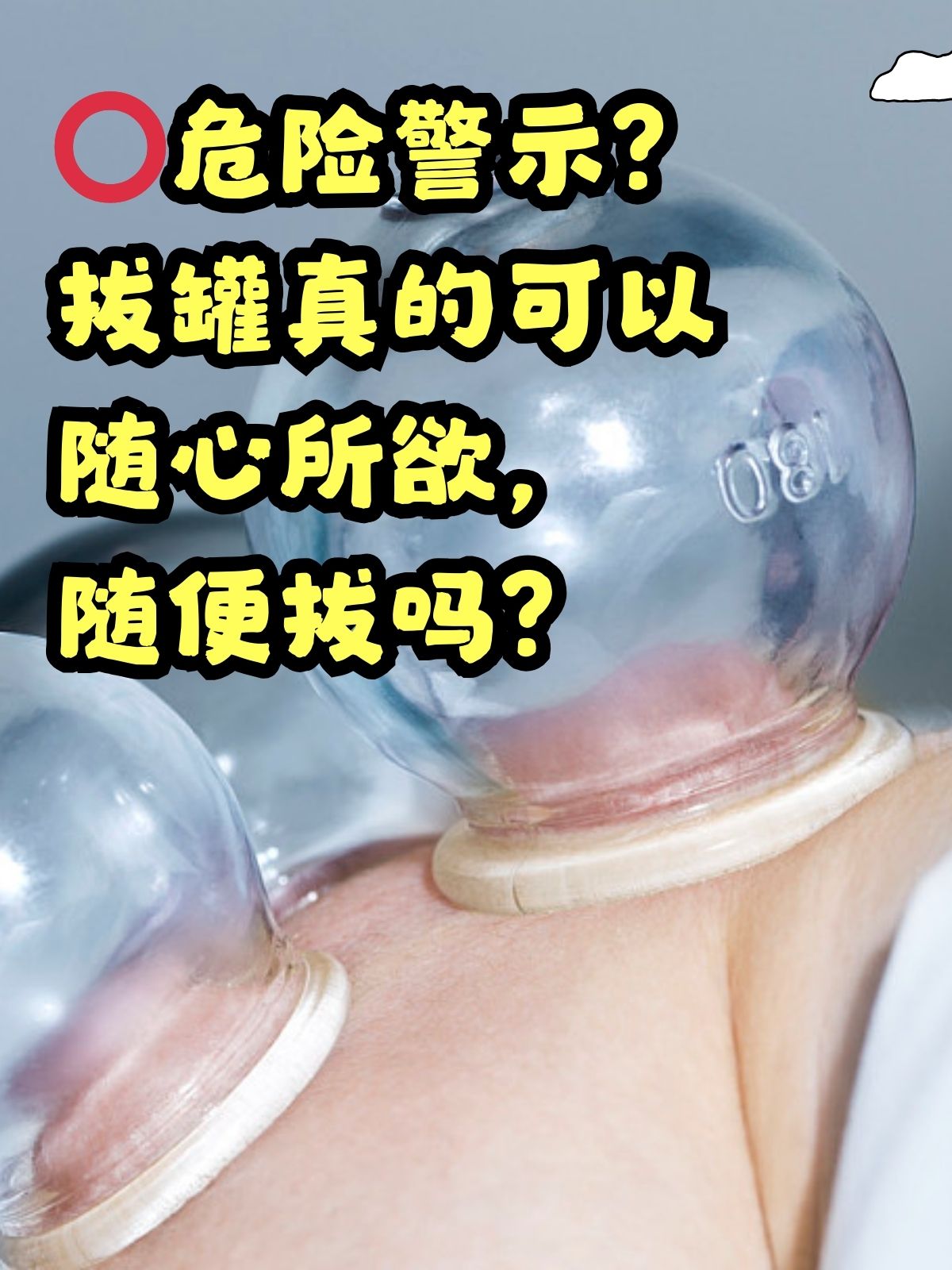 拔火罐,多长时间拔一次?