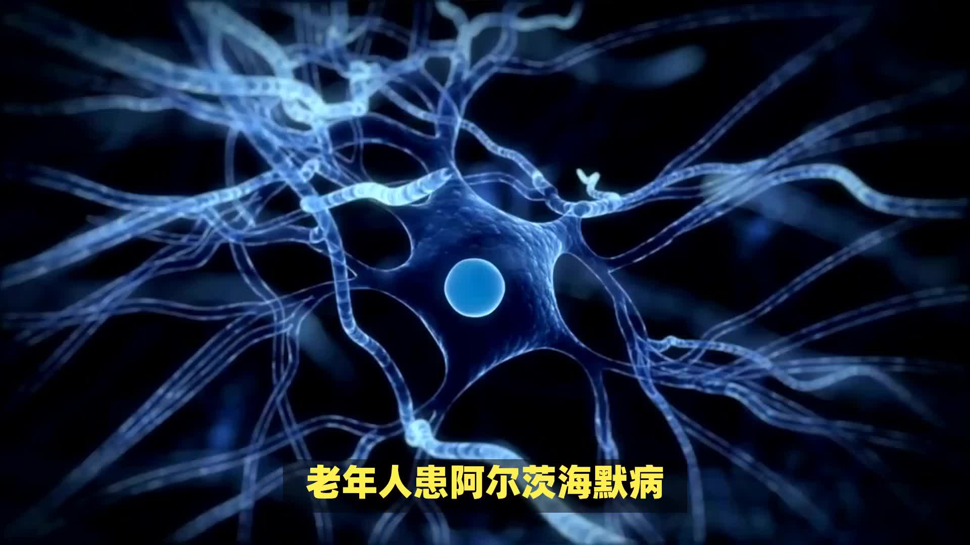 阿尔茨海默病的早期症状