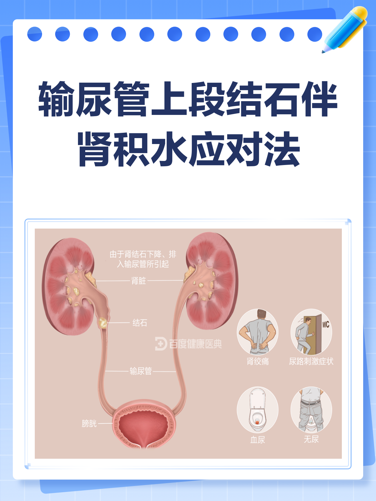 肾积水怎么治疗比较好?