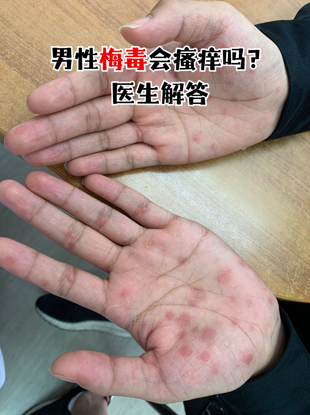男性梅毒的症状有哪些