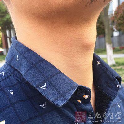 喉结大是病吗?