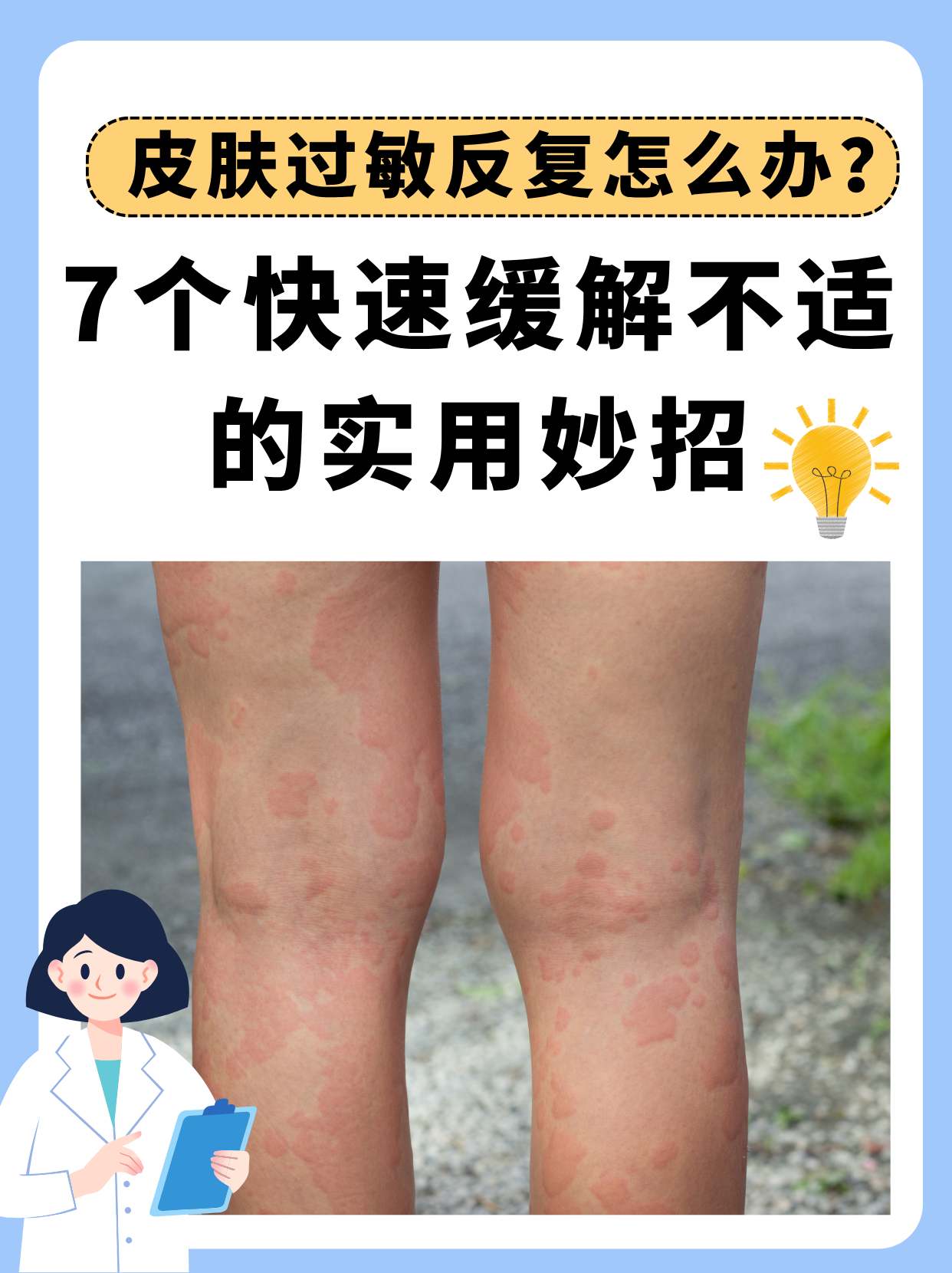 过敏性皮炎怎么根治?