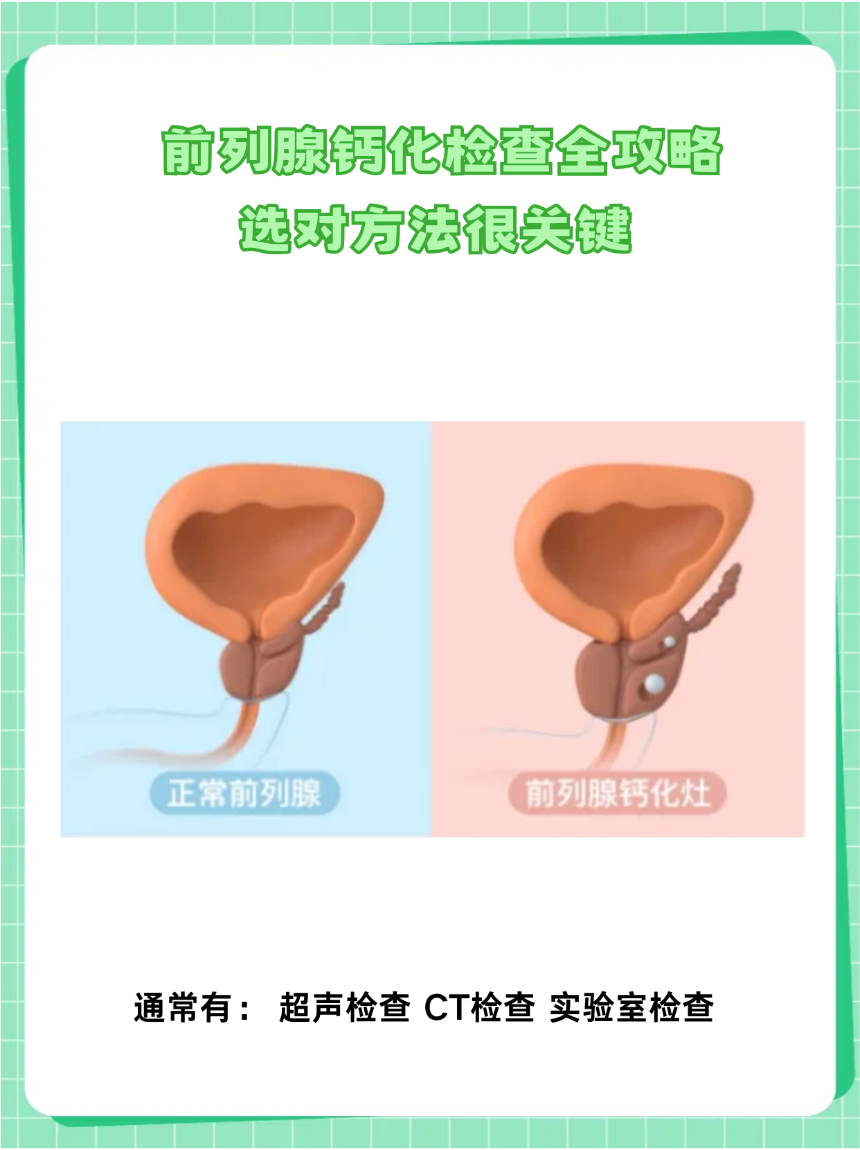 年轻人会不会得前列腺钙化灶?