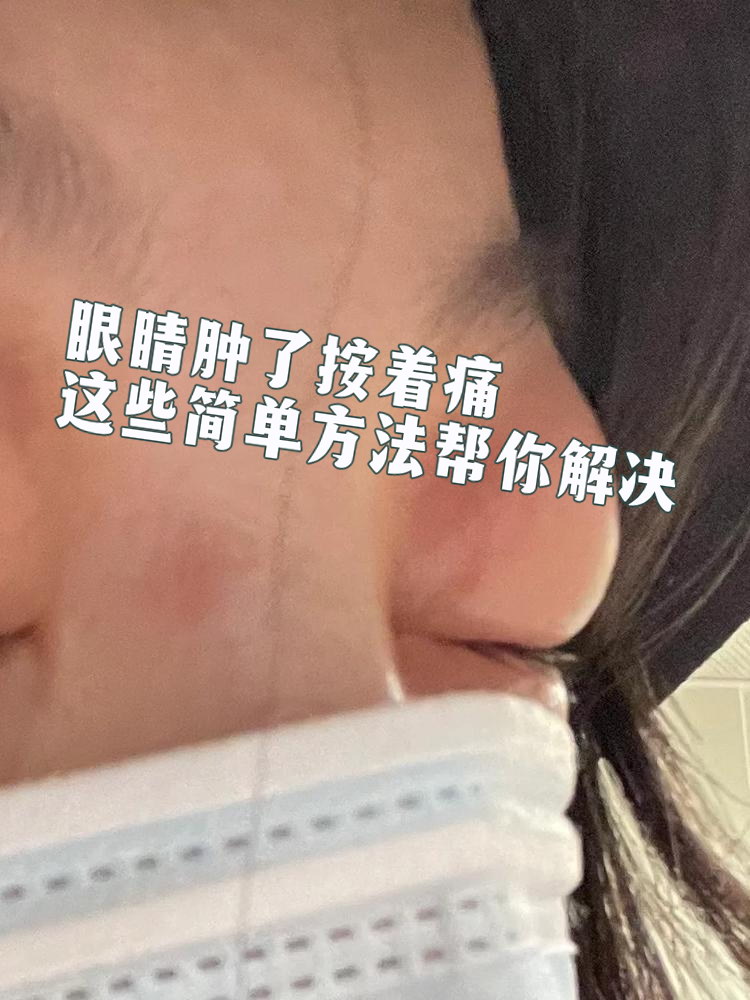 眼睛红肿怎么又痛怎么办