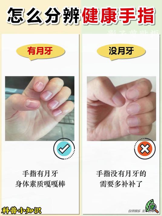 为什么只有大拇指有月牙其他都没有