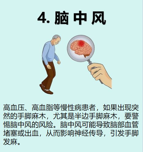 手麻是中风前兆吗