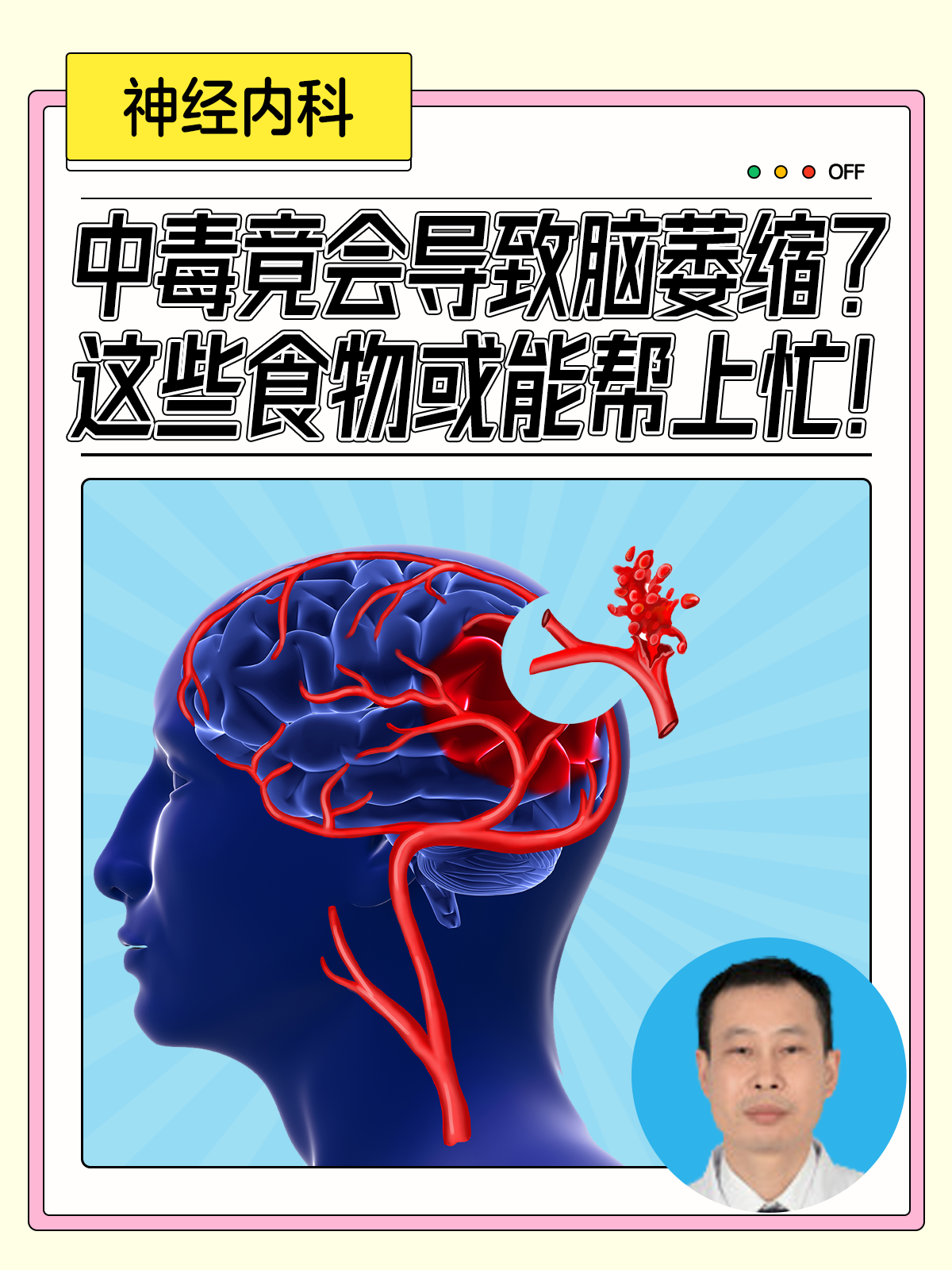 一氧化碳中毒后迟发性脑病临床症状