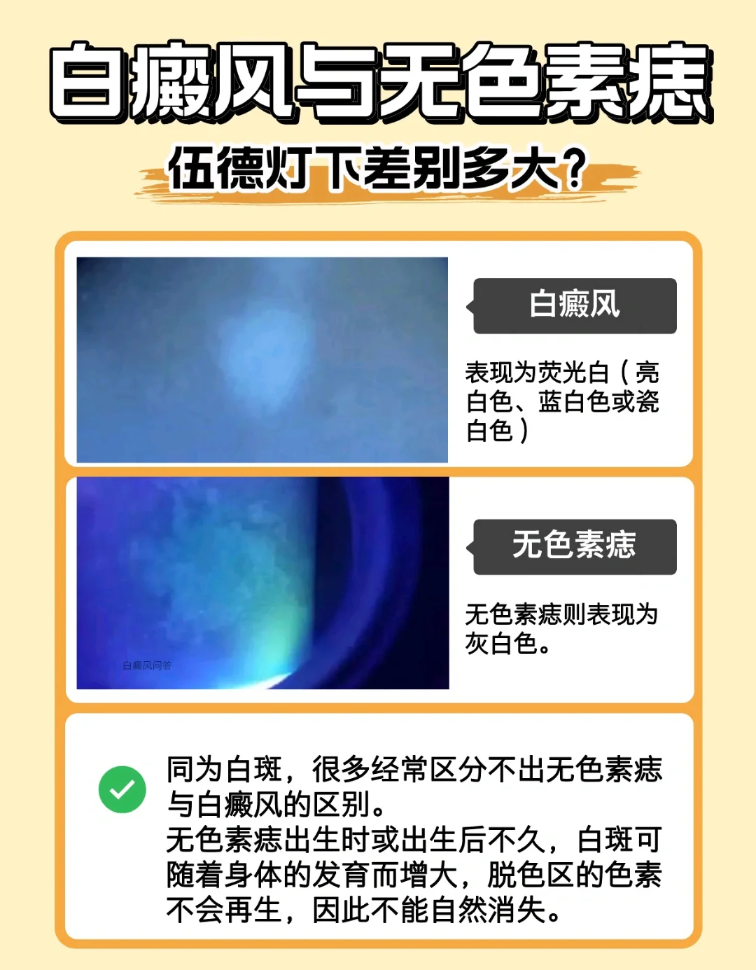 色素脱失怎么治疗?