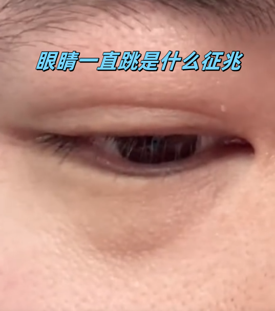 眼球震颤是怎么回事