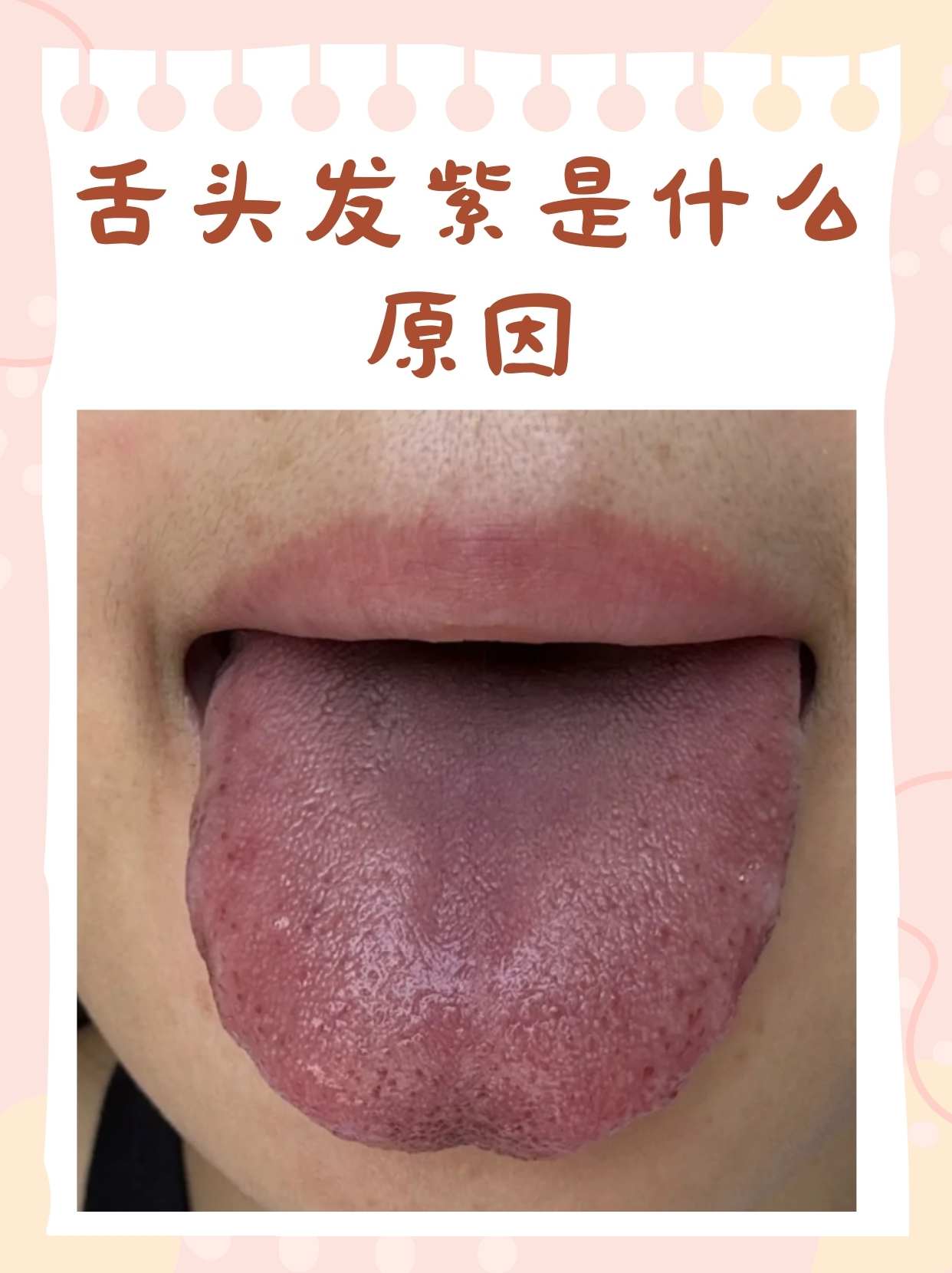 舌头中间发黑是怎么回事
