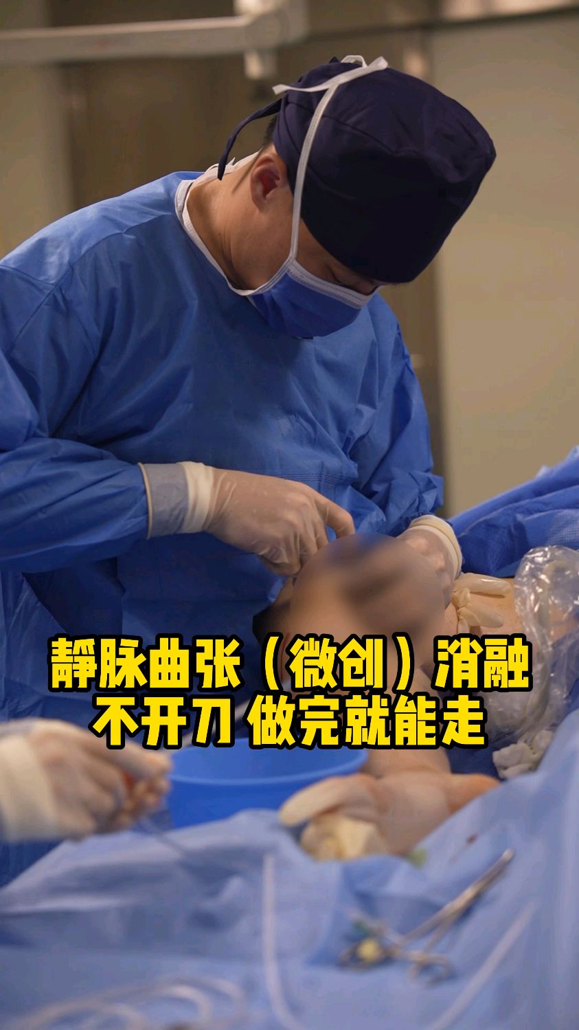 静脉曲张手术