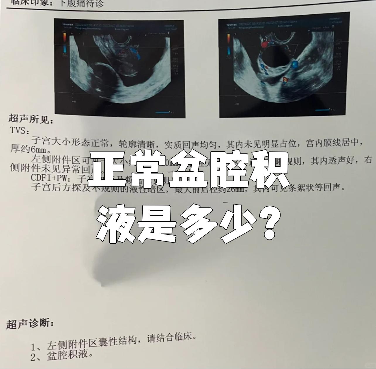 子宫里有积液是怎么回事