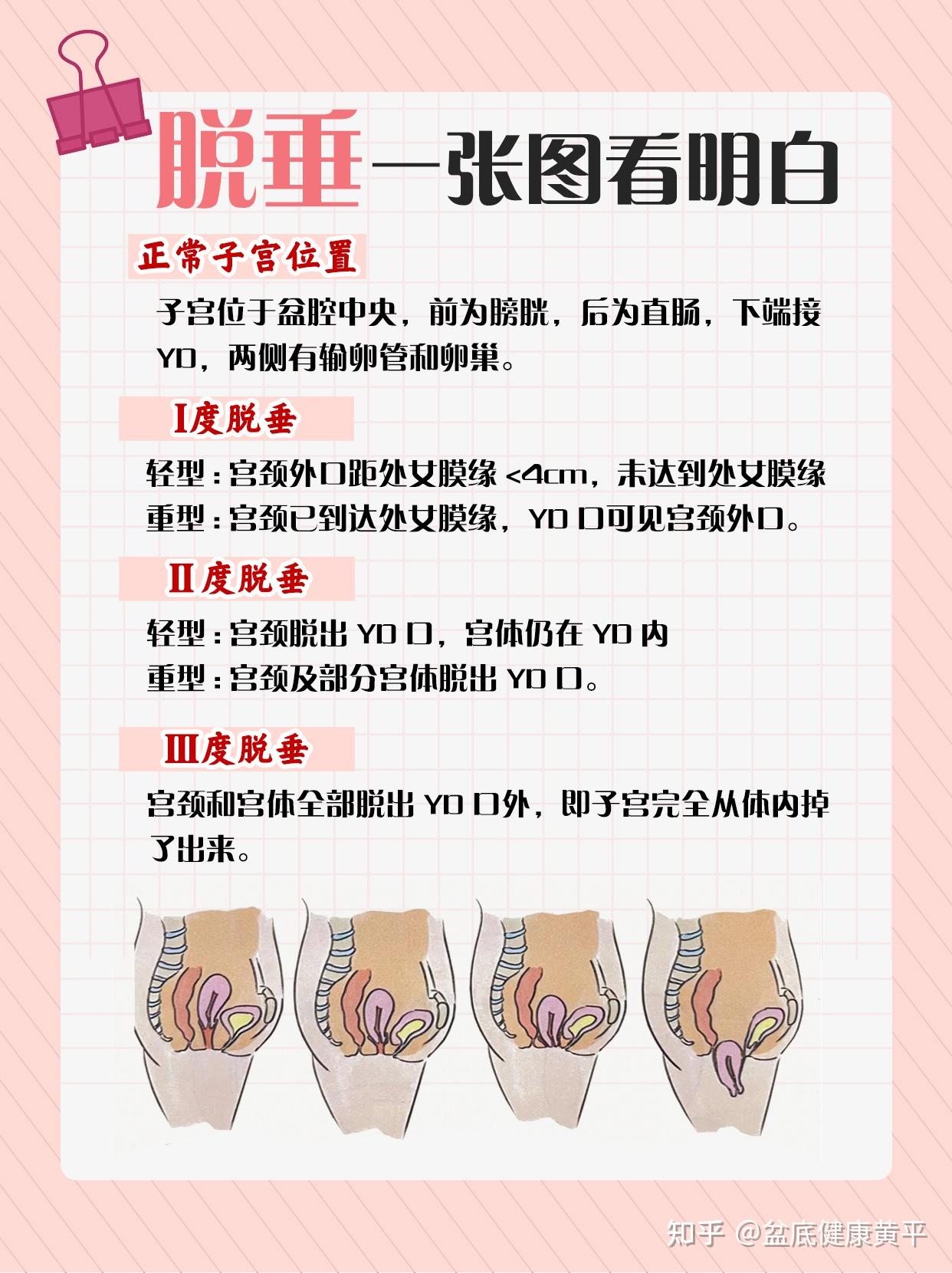 子宫萎缩的症状有哪些