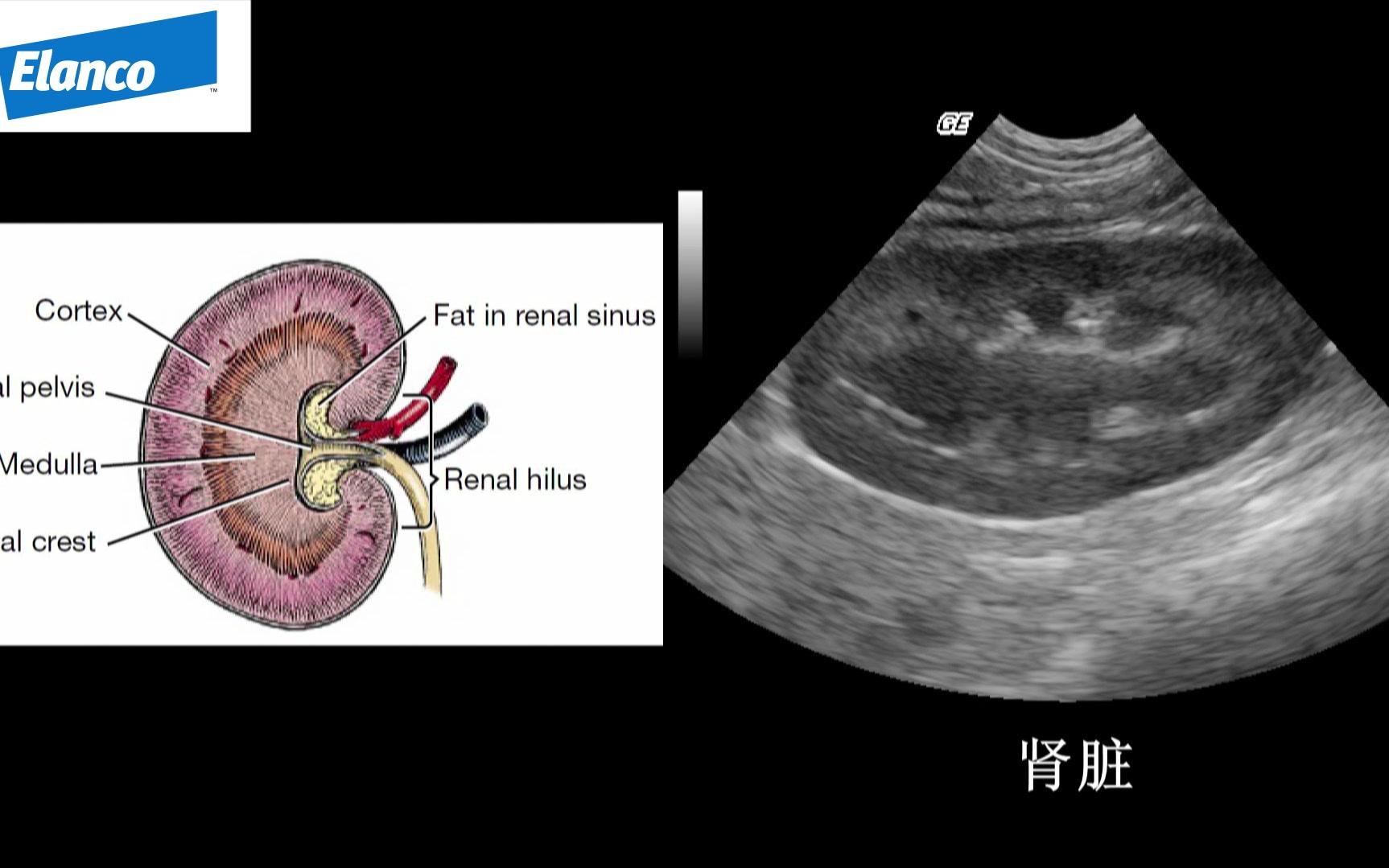 正常肾脏超声图像是怎样的