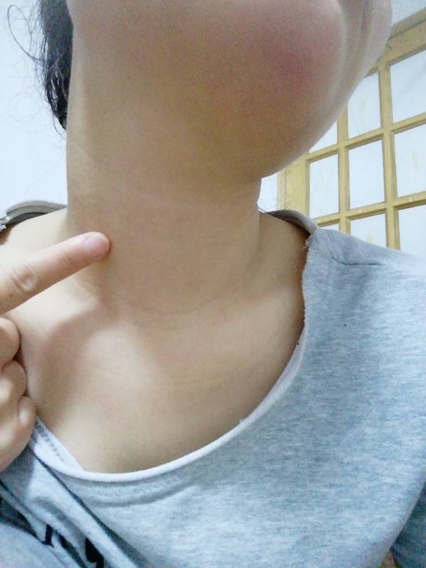 脖子前面疼