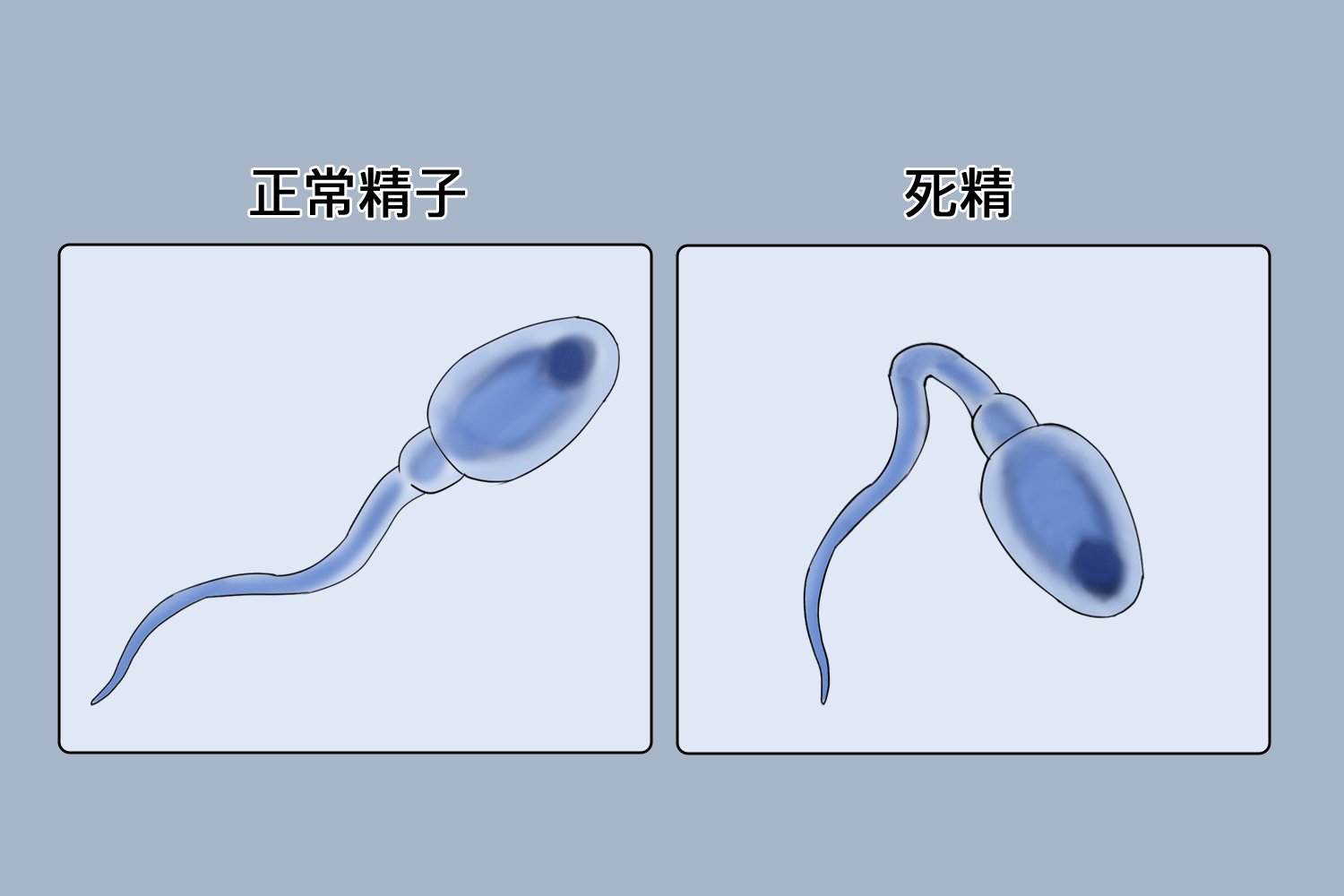 死精是什么原因