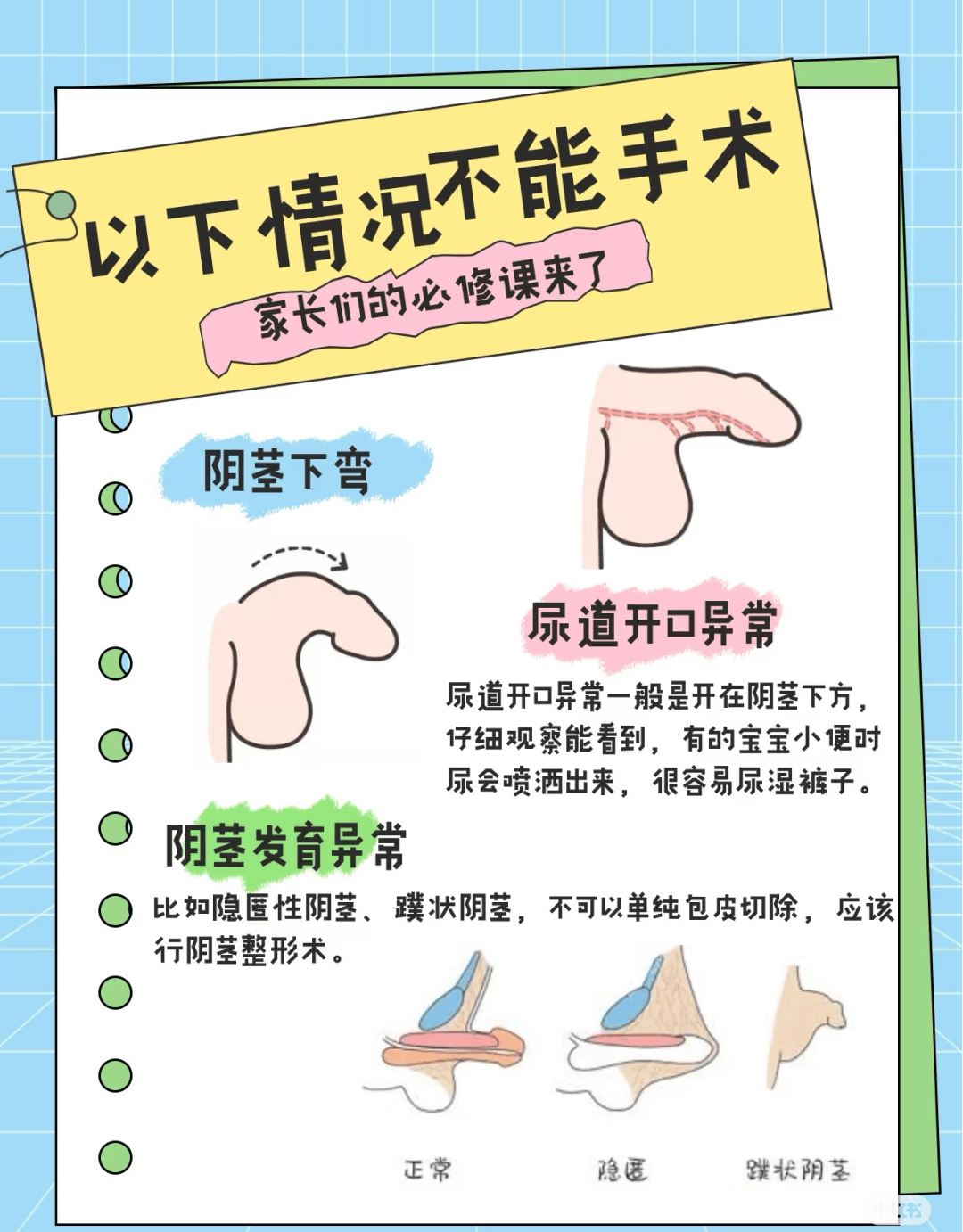 小儿包皮过长