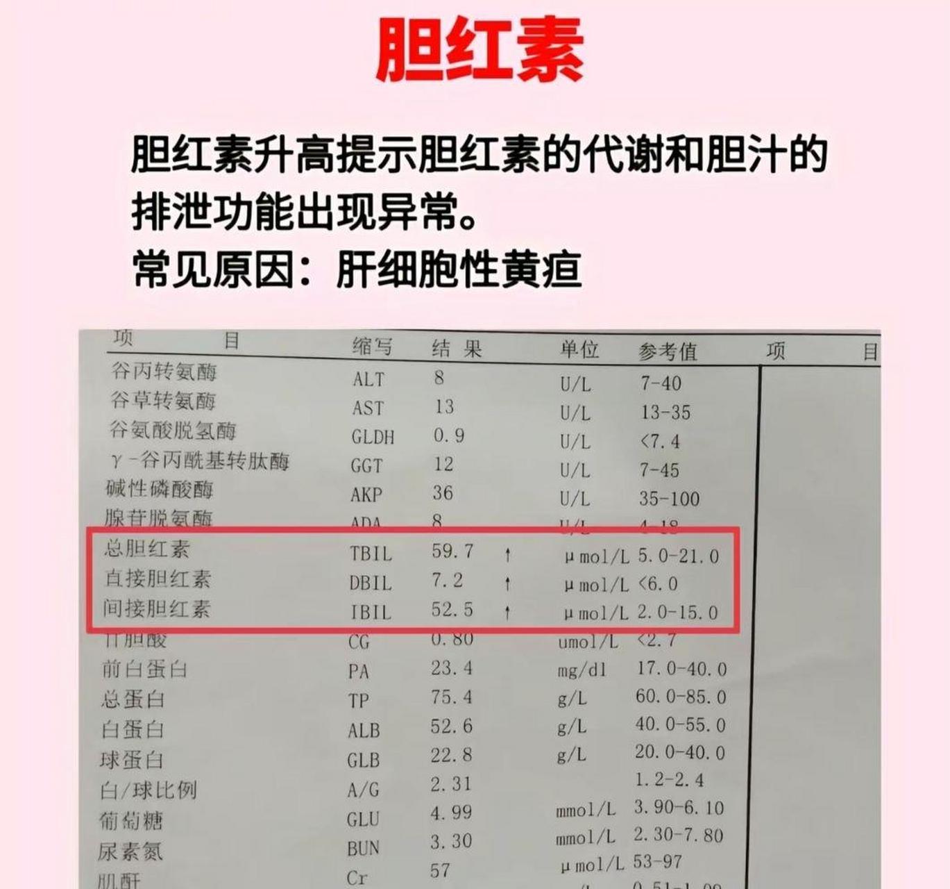 总胆红素和直接胆红素偏高是什么原因
