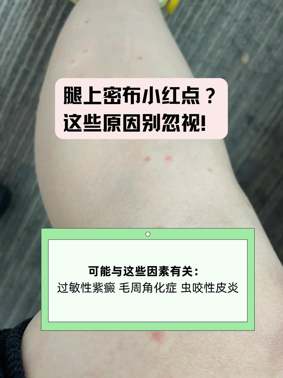 腿上有红点是怎么回事