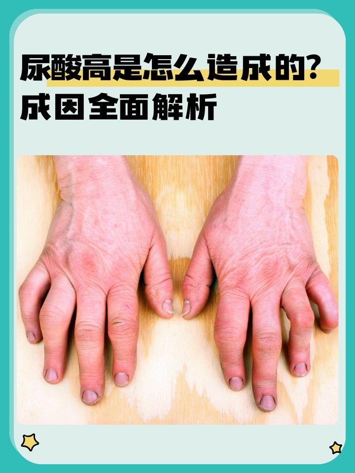 尿酸高有什么危害??